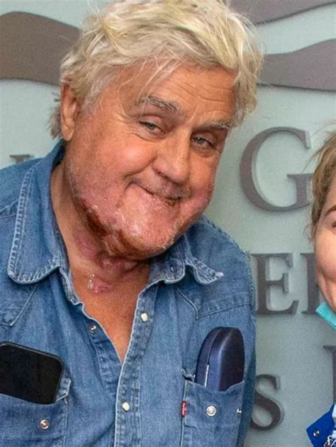 cost to hire jay leno|jay leno accident.